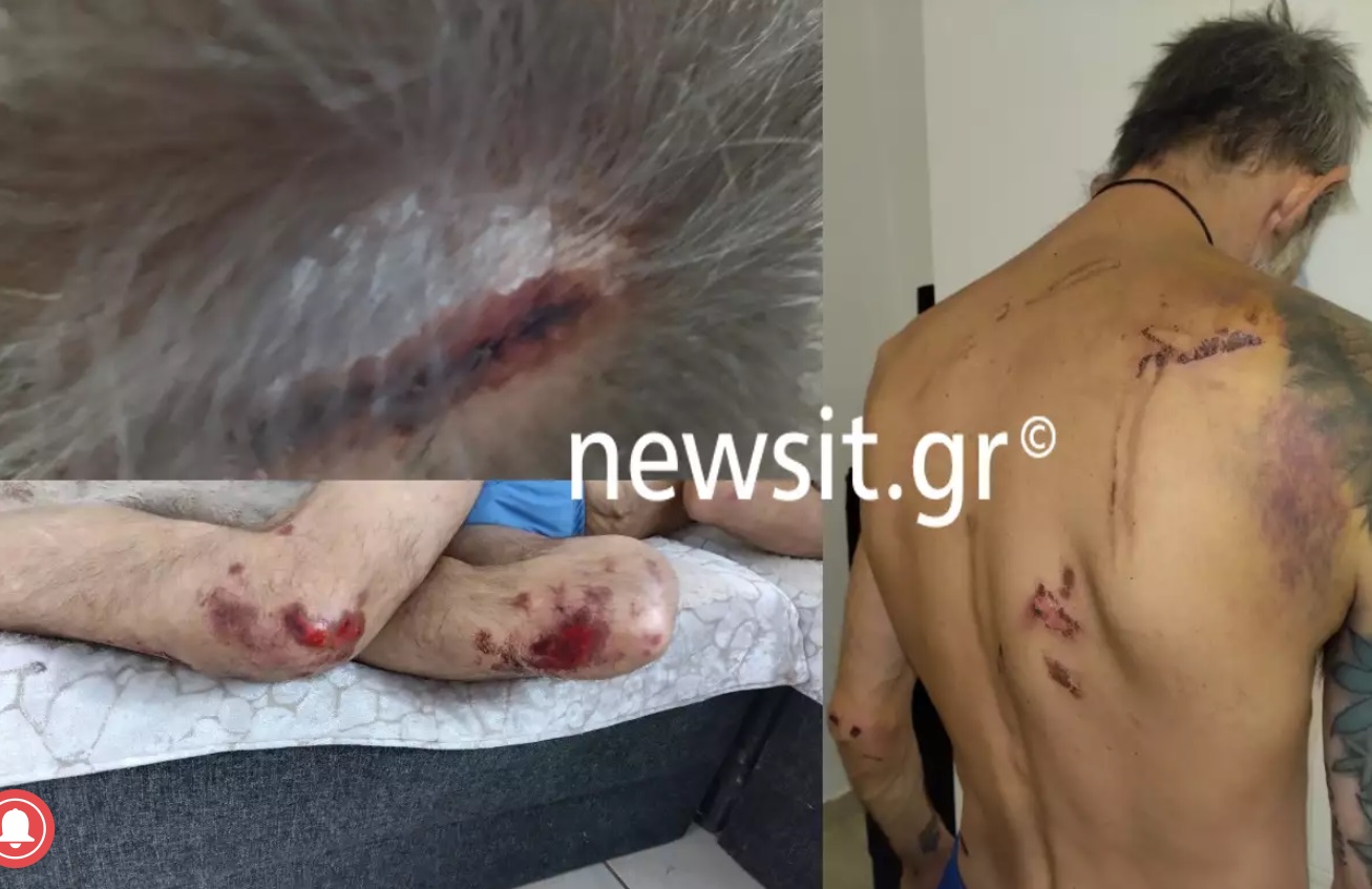 Μιχάλης Κατσουρής: Εικόνες σοκ από τον ξυλοδαρμό του 48χρονου φίλου της ΑΕΚ – «Θα αξιώσουμε αποζημίωση από το Ελληνικό κράτος»
