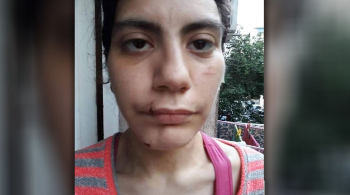 Φαίη Μπακογιώργου: «Την χτυπούσε αλλοδαπός στη Φωκίωνος Νέγρη» - Νέα στοιχεία για τη δολοφονία της